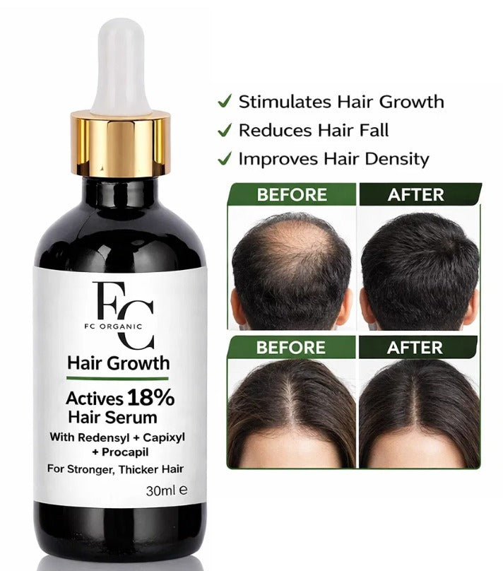Herbal Hair Growth Serum 30ml | Rosemary & Onion Water-Based Formula. 3763926